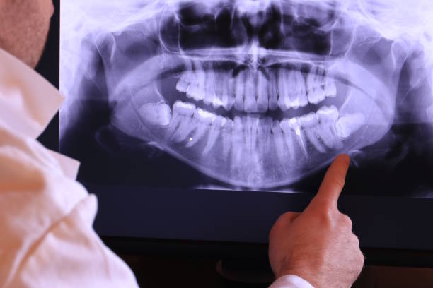 Best Tooth Infection Emergency Dentist  in George West, TX