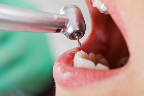 Best Emergency Tooth Extraction  in George West, TX